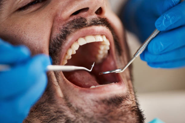 Best Emergency Tooth Extraction in North Seekonk, MA